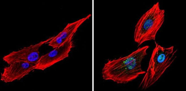 CREB Antibody in Immunocytochemistry (ICC/IF)