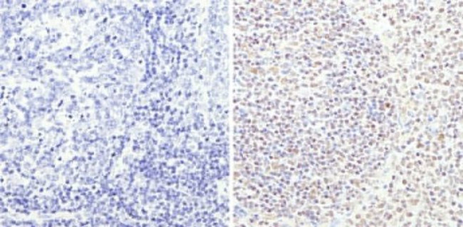 TRIM28 Antibody in Immunohistochemistry (Paraffin) (IHC (P))