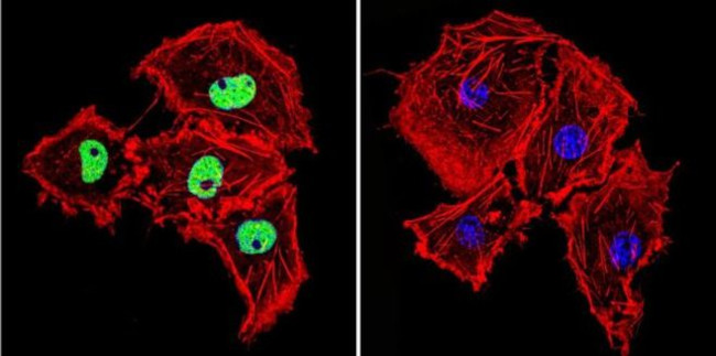 HDAC2 Antibody in Immunocytochemistry (ICC/IF)