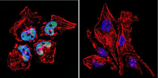 HDAC2 Antibody in Immunocytochemistry (ICC/IF)