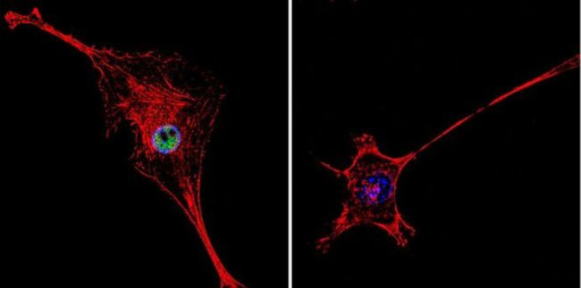 HDAC2 Antibody in Immunocytochemistry (ICC/IF)