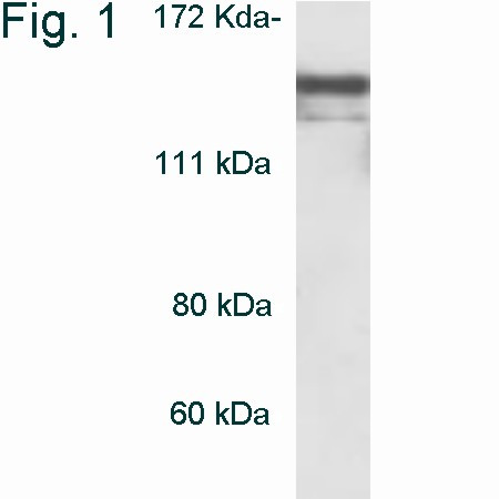 HDAC4 Antibody in Western Blot (WB)