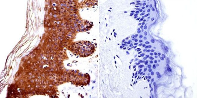 HDAC4 Antibody in Immunohistochemistry (Paraffin) (IHC (P))