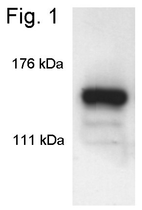 SIN3A Antibody in Western Blot (WB)