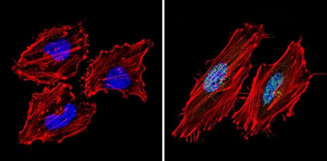 SIN3A Antibody in Immunocytochemistry (ICC/IF)