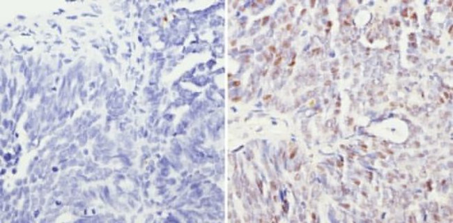 SIN3A Antibody in Immunohistochemistry (Paraffin) (IHC (P))