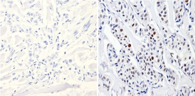 DNMT3B Antibody in Immunohistochemistry (Paraffin) (IHC (P))