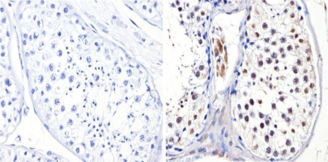 DNMT3B Antibody in Immunohistochemistry (Paraffin) (IHC (P))