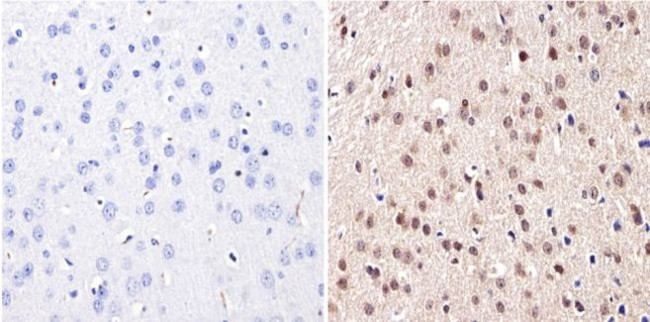 DNMT3B Antibody in Immunohistochemistry (Paraffin) (IHC (P))