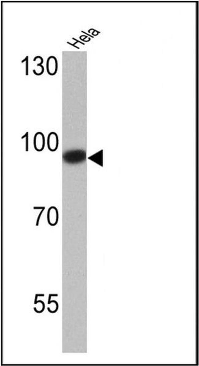 DNMT3B Antibody in Western Blot (WB)