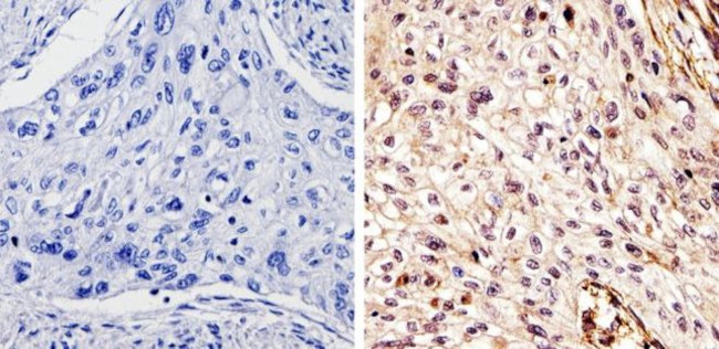 DMAP1 Antibody in Immunohistochemistry (Paraffin) (IHC (P))