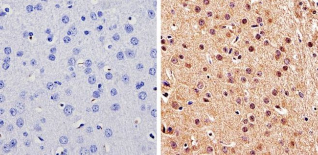 DMAP1 Antibody in Immunohistochemistry (Paraffin) (IHC (P))