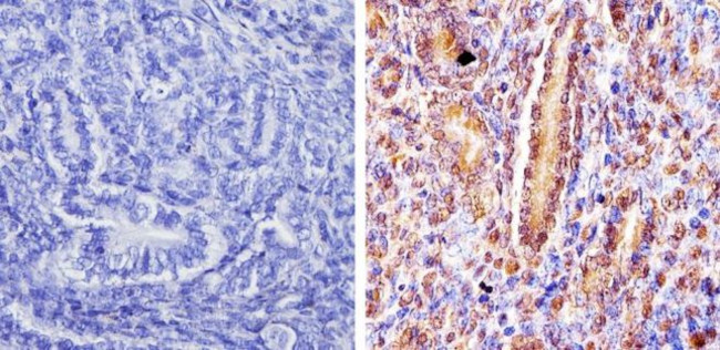 DMAP1 Antibody in Immunohistochemistry (Paraffin) (IHC (P))