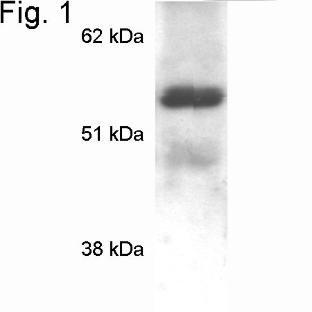 MECP2 Antibody in Western Blot (WB)