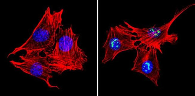 MECP2 Antibody in Immunocytochemistry (ICC/IF)