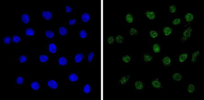 MECP2 Antibody in Immunocytochemistry (ICC/IF)