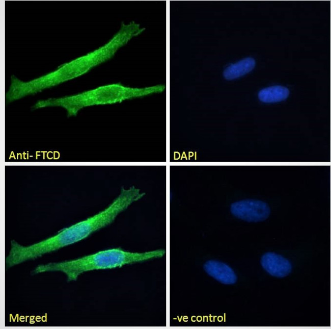 Golgi protein 58k Antibody in Immunocytochemistry (ICC/IF)