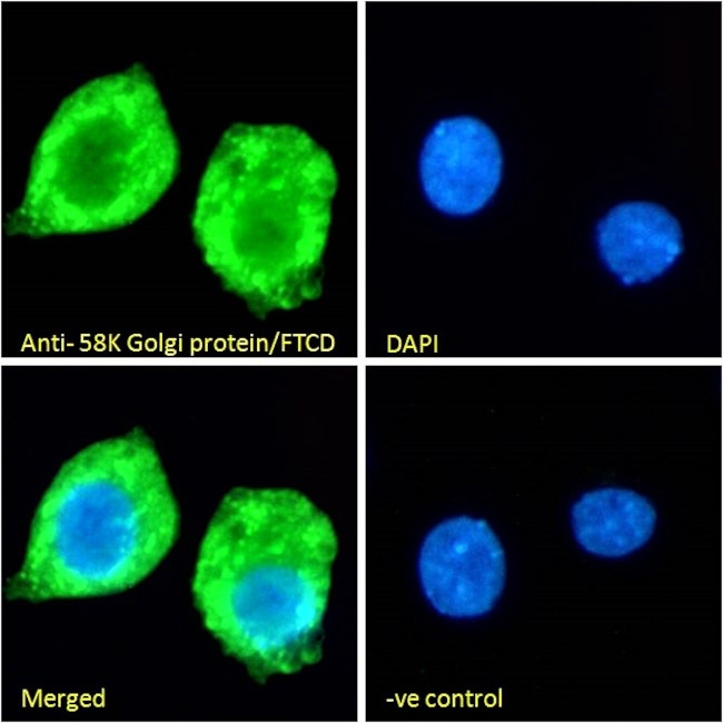 Golgi protein 58k Antibody in Immunocytochemistry (ICC/IF)