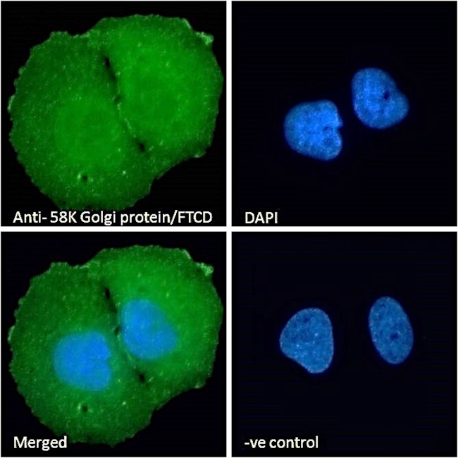 Golgi protein 58k Antibody in Immunocytochemistry (ICC/IF)