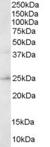 ERAB Antibody in Western Blot (WB)