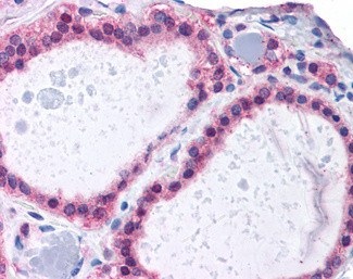 ADAM17 Antibody in Immunohistochemistry (Paraffin) (IHC (P))