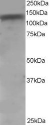 ADAM17 Antibody in Western Blot (WB)