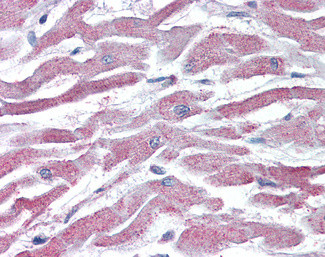 AKT3 Antibody in Immunohistochemistry (Paraffin) (IHC (P))