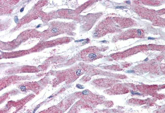 AKT3 Antibody in Immunohistochemistry (Paraffin) (IHC (P))