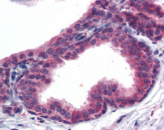 AKT3 Antibody in Immunohistochemistry (Paraffin) (IHC (P))