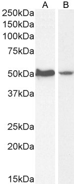 AKT3 Antibody in Western Blot (WB)