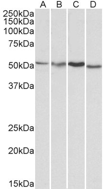 AKT3 Antibody in Western Blot (WB)