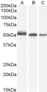 AKT3 Antibody in Western Blot (WB)