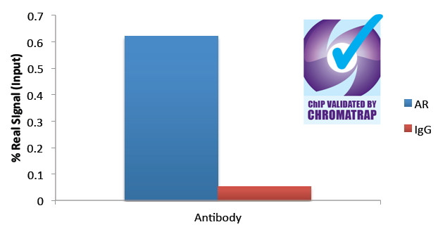 Androgen Receptor Antibody in ChIP Assay (ChIP)