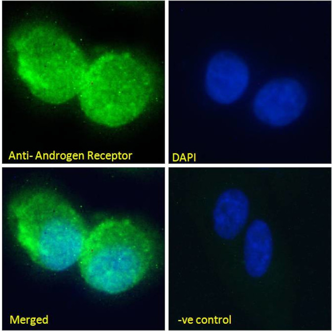 Androgen Receptor Antibody in Immunocytochemistry (ICC/IF)