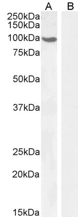 Androgen Receptor Antibody in Western Blot (WB)