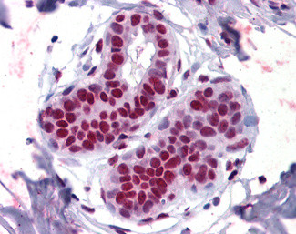 APE1 Antibody in Immunohistochemistry (Paraffin) (IHC (P))