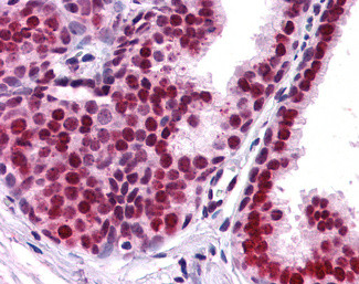 APE1 Antibody in Immunohistochemistry (Paraffin) (IHC (P))