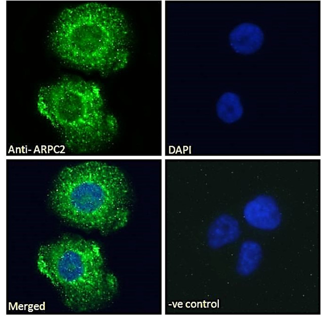 ARPC2 Antibody in Immunocytochemistry (ICC/IF)