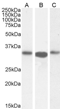 ARPC2 Antibody in Western Blot (WB)