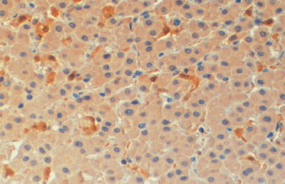 PYCARD Antibody in Immunohistochemistry (Paraffin) (IHC (P))