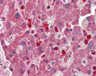 PYCARD Antibody in Immunohistochemistry (Paraffin) (IHC (P))