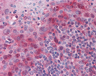 PYCARD Antibody in Immunohistochemistry (Paraffin) (IHC (P))