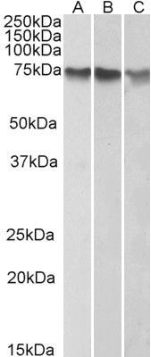 ATF2 Antibody in Western Blot (WB)