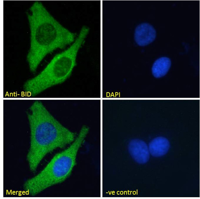 BID Antibody in Immunocytochemistry (ICC/IF)