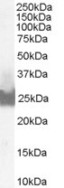 BID Antibody in Western Blot (WB)