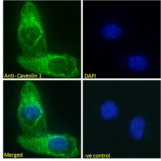 Caveolin 1 Antibody in Immunocytochemistry (ICC/IF)