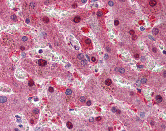 p16INK4a Antibody in Immunohistochemistry (Paraffin) (IHC (P))