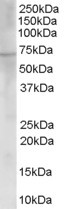 ChAT Antibody in Western Blot (WB)