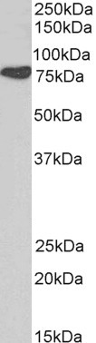 Cortactin Antibody in Western Blot (WB)