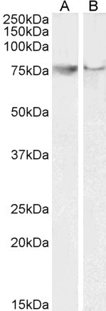 COX2 Antibody in Western Blot (WB)